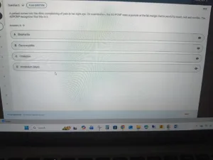 NR576 Week 4 Midterm Exam Sept 26